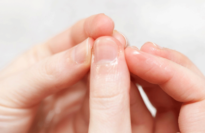 The main causes of nail fungus